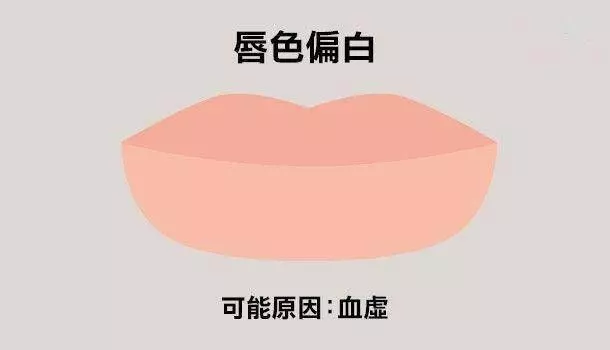 6種常見唇色看健康，嘴唇乾裂、破皮、偏白是什麼狀況？