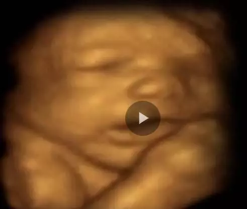 一段讓人淚流滿面的小胎兒獨白，感歎生命的偉大