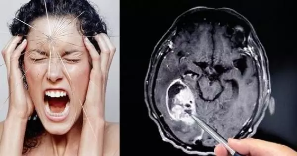這6種頭痛不能忍！如果一用力咳嗽就會頭痛，那你一定要儘速就醫！！