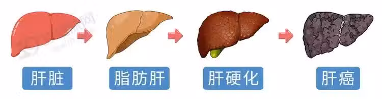 /www/bananadaily.net/web/images/image/2266/22662293.avif