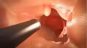 /www/bananadaily.net/web/images/image/2268/22685466.avif