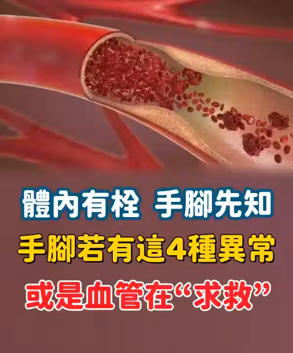 /www/bananadaily.net/web/images/image/2274/22749049.avif